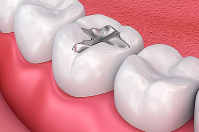 Perfect Smile Dental Studio | Veneers, Preventative Program and Dental Cleanings