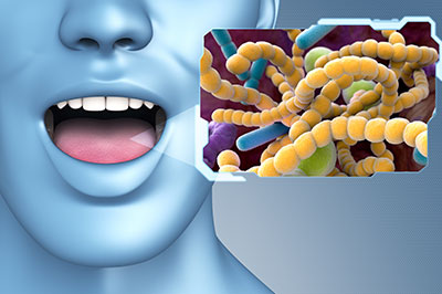 Perfect Smile Dental Studio | Oral Exams, Dental Cleanings and Invisalign reg 