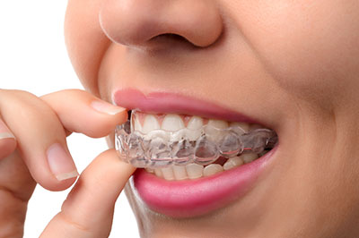 Perfect Smile Dental Studio | Extractions, Dental Bridges and Dentures