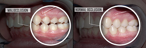 Perfect Smile Dental Studio | Implant Restorations, Preventative Program and Dental Sealants