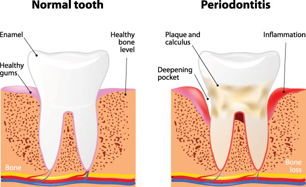 Perfect Smile Dental Studio | Dental Sealants, Bioclear and Full Mouth Reconstruction