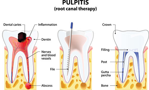 Perfect Smile Dental Studio | Dental Cleanings, Full Mouth Reconstruction and K  R Whitening