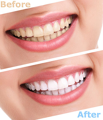 Perfect Smile Dental Studio | Oral Exams, Pediatric Dentistry and Dental Cleanings