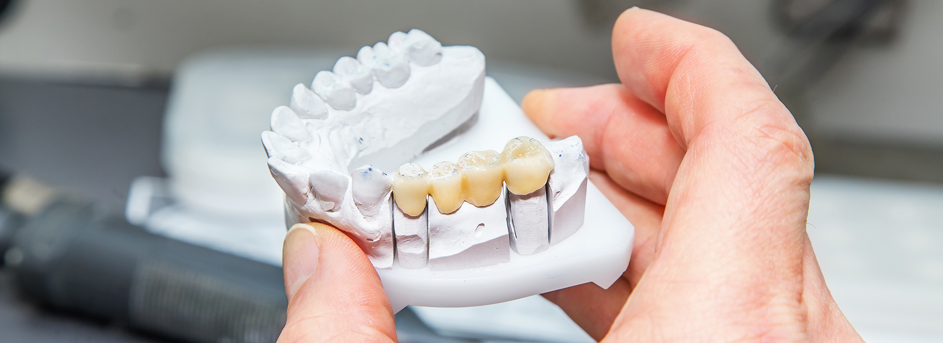 Perfect Smile Dental Studio | Oral Cancer Screening, Dental Bridges and Fluoride Treatment