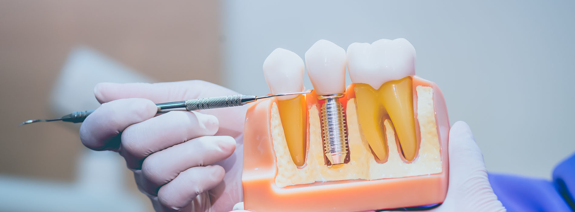 Perfect Smile Dental Studio | Implant Dentistry, Dentures and Inlays  amp  Onlays