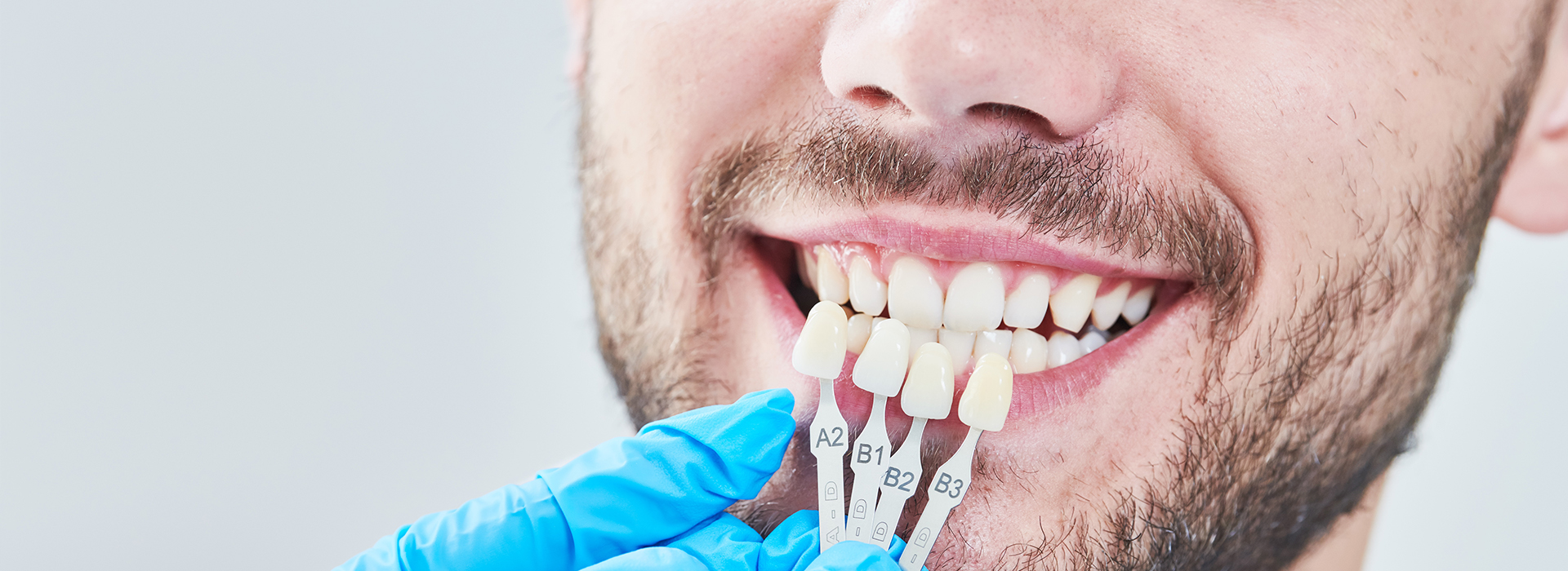 Perfect Smile Dental Studio | Dental Sealants, Extractions and K  R Whitening
