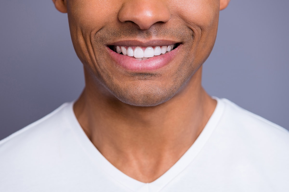 3 Options For Whitening Your Teeth Blog